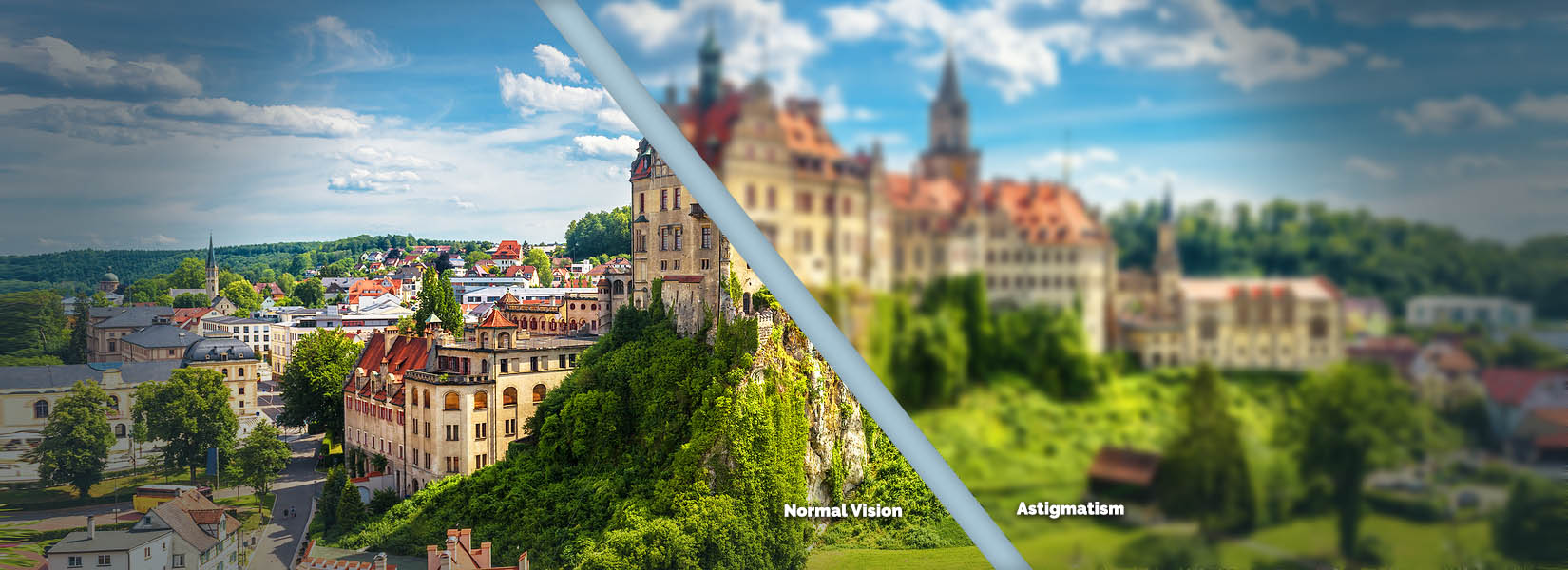 Astigmatism Treatment in Carondelet