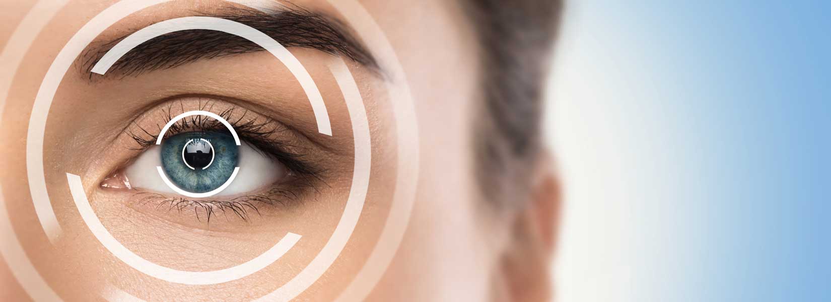 LASIK & Refractive Surgery Co-Management in Carondelet